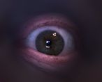 Eyeball
